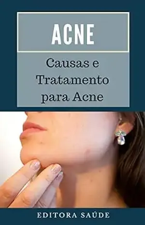 Acne: Causas e Tratamento para Acne – Editora Saúde