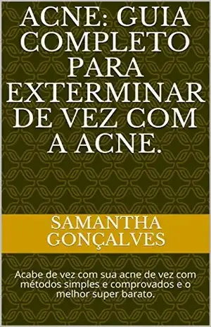 Acne: Guia completo para exterminar de vez com a Acne.: Acabe de vez com sua acne de vez com métodos simples e comprovados e o melhor super barato. – Samantha Gonçalves