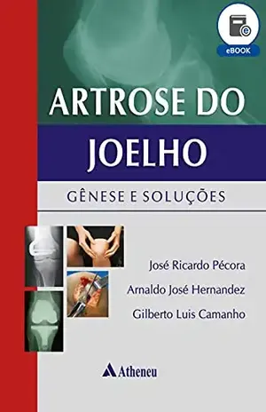 Artrose do Joelho – Gênese e Soluções (eBook) – Arnaldo José Hernandez