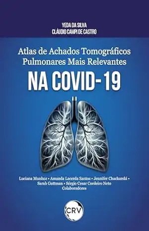 Atlas de achados tomográficos pulmonares mais relevantes na COVID–19 – Yeda da Silva