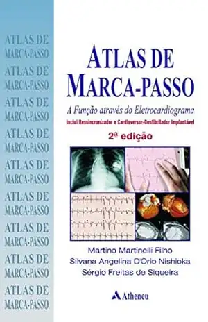 Atlas de Marca Passo – A Função Através do Eletrocardiograma (eBook) - Martino Martinelli Filho