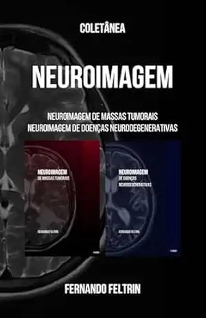 Coletânea NEUROIMAGEM – Fernando Belomé Feltrin – Fernando Belomé Feltrin