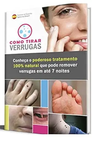 Como Eliminar Verrugas em 7 dias ! Dê Adeus as Verrugas – MARCELO OLIVEIRA