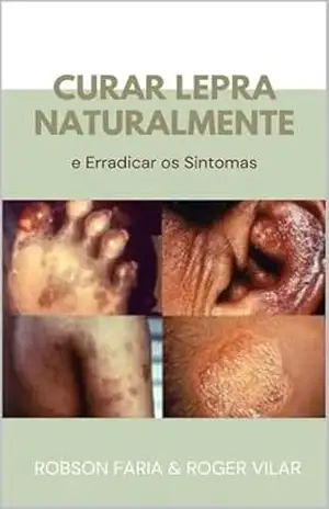 Curar Lepra Naturalmente: E Erradicar os Sintoma - Robson Faria
