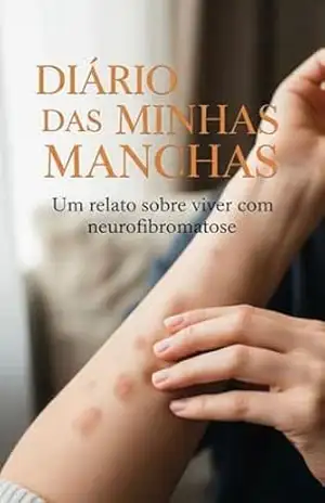 Diário das Minhas Manchas: Um relato sobre viver com neurofibromatose – Rosa  Negra