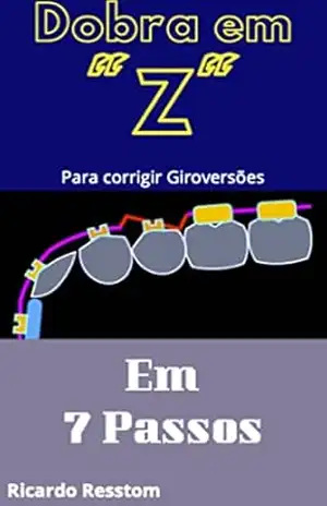 Dobra em “Z” em 7 passos – Parte I: Corrigindo as Giro–Versões (Ortodontia: Como confeccionar uma Dobra em “Z” em 7 passos) – Ricardo Resstom