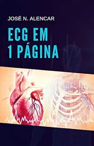 ECG em 1 Página - José Nunes de Alencar Neto