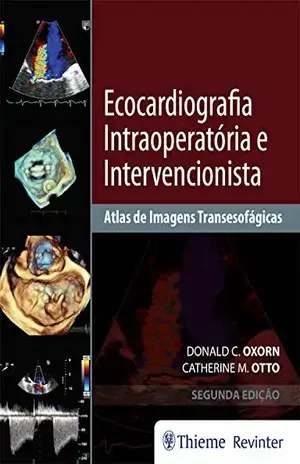 Ecocardiografia Intraoperatória e Intervencionista: Atlas de Imagens Tansesofágicas – Donald C. Oxorn