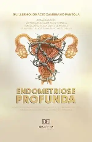 Endometriose Profunda: a importância da ultrassonografia e dos biomarcadores imunológicos para o diagnóstico precoce – Guillermo Ignácio Zambrano Pantoja