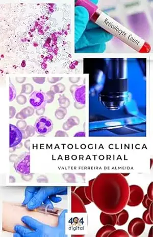 Hematologia Clínica Laboratorial – Valter Ferreira de Almeida