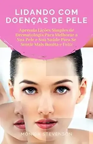 Lidando Com Doenças De Pele: Aprenda Lições Simples De Dermatologia Para Melhorar A Sua Pele, Lições Básicas de Estética Para a Sua Pele E Sua Saúde Para Se Sentir Mais Bonita E Feliz – Monica Stevenson