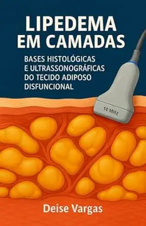 LIPEDEMA EM CAMADAS: BASES HISTOLÓGICAS E ULTRASSONOGRÁFICAS DO TECIDO ADIPOSO DISFUNCIONAL - DEISE VARGAS