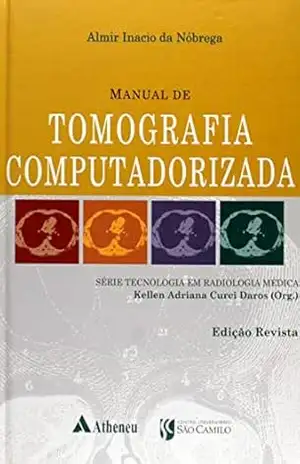 Manual de Tomografia Computadorizada (eBook) – Almir Inácio da Nóbrega