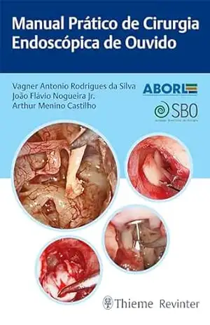 Manual Prático de Cirurgia Endoscópica de Ouvido – Vagner Antonio Rodrigues da Silva