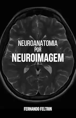 NEUROANATOMIA POR NEUROIMAGEM – Fernando Belomé Feltrin