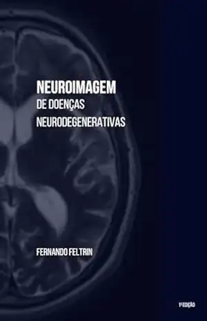 Neuroimagem de Doenças Neurodegenerativas – Fernando Belomé Feltrin