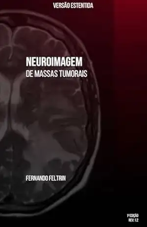 Neuroimagem de Massas Tumorais: Versão Estendida – Fernando Belomé Feltrin