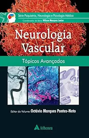 Neurologia Vascular: Tópicos Avançados (eBook) (0) – Octávio Marques Pontes-Neto