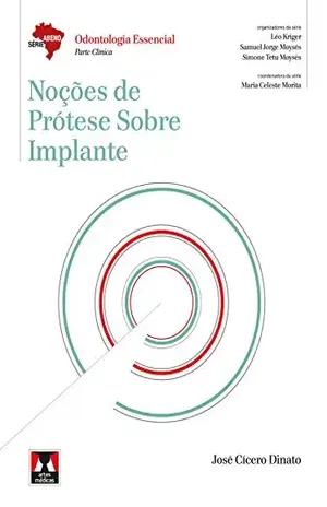 Noções de Prótese sobre Implante (Abeno) – Jose Cicero Dinato