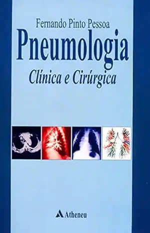 Pneumologia – Clínica e Cirúrgica (eBook) – Fernando Pinto Pessoa