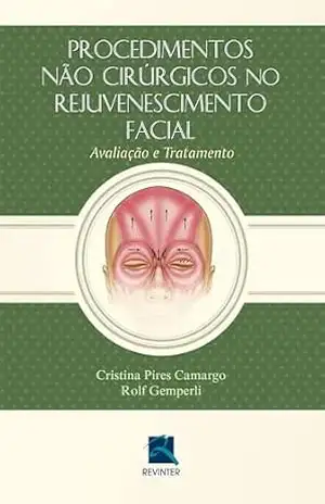 Procedimentos não Cirúrgicos no Rejuvenescimento Facial: Avaliação e Tratamento – Rolf Gemperli