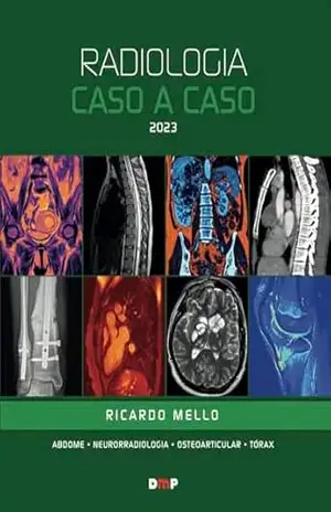 Radiologia Caso a Caso 2023 – Ricardo Mello