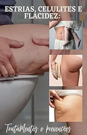 Regenere seu corpo em 30 dias: Tratamentos e prevenções (estrias, celulites, flacidez, varizes e rugas) – Yasmin Munhos