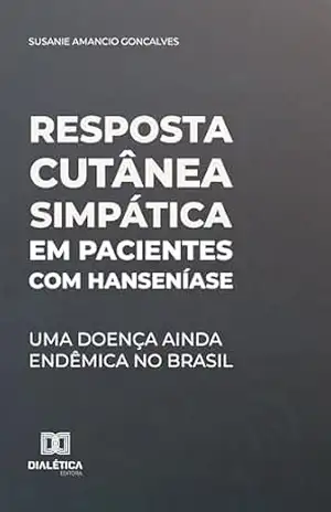 Resposta cutânea simpática em pacientes com Hanseníase: Uma doença ainda endêmica no Brasil – Susanie Amancio Goncalves