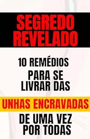 SEGREDO REVELADO 10 REMEDIOS PARA SE LIVRAR DAS UNHA ENCRAVADA – Erick  Ferreira