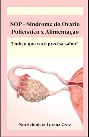 SOP – SINDROME DO OVARIO POLICISTICOX ALIMENTAÇÃO: TUDO QUE VOCE PRECISA SABER! - LORENA  RODRIGUES SOARES CRUZ