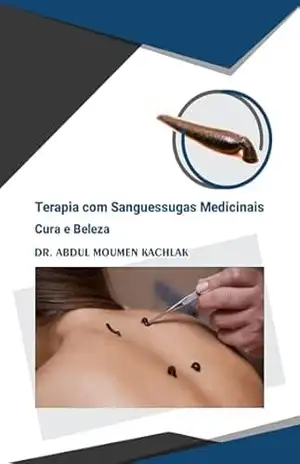 Terapia com Sanguessugas Cura e Beleza - Dr. Abdul Moumen Kachlak