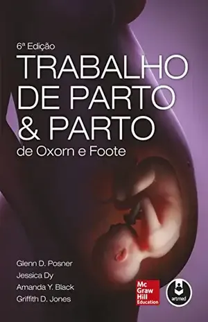 Trabalho de parto e parto de Oxorn–Foote - Glenn D. Posner