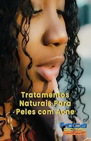 TRATAMENTOS NATURAIS PARA PELES COM ACNE – ANTONIO QUEIROZ